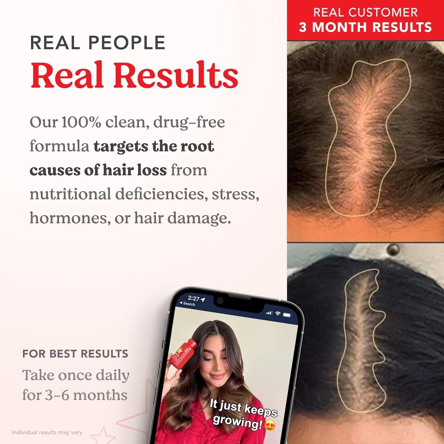 Premium Hair Growth Vitamins for Men and Women