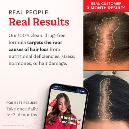 Premium Hair Growth Vitamins for Men and Women