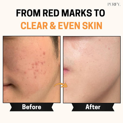 Natural Vitamin C Face Serum 30ml - Anti Aging Skin Care