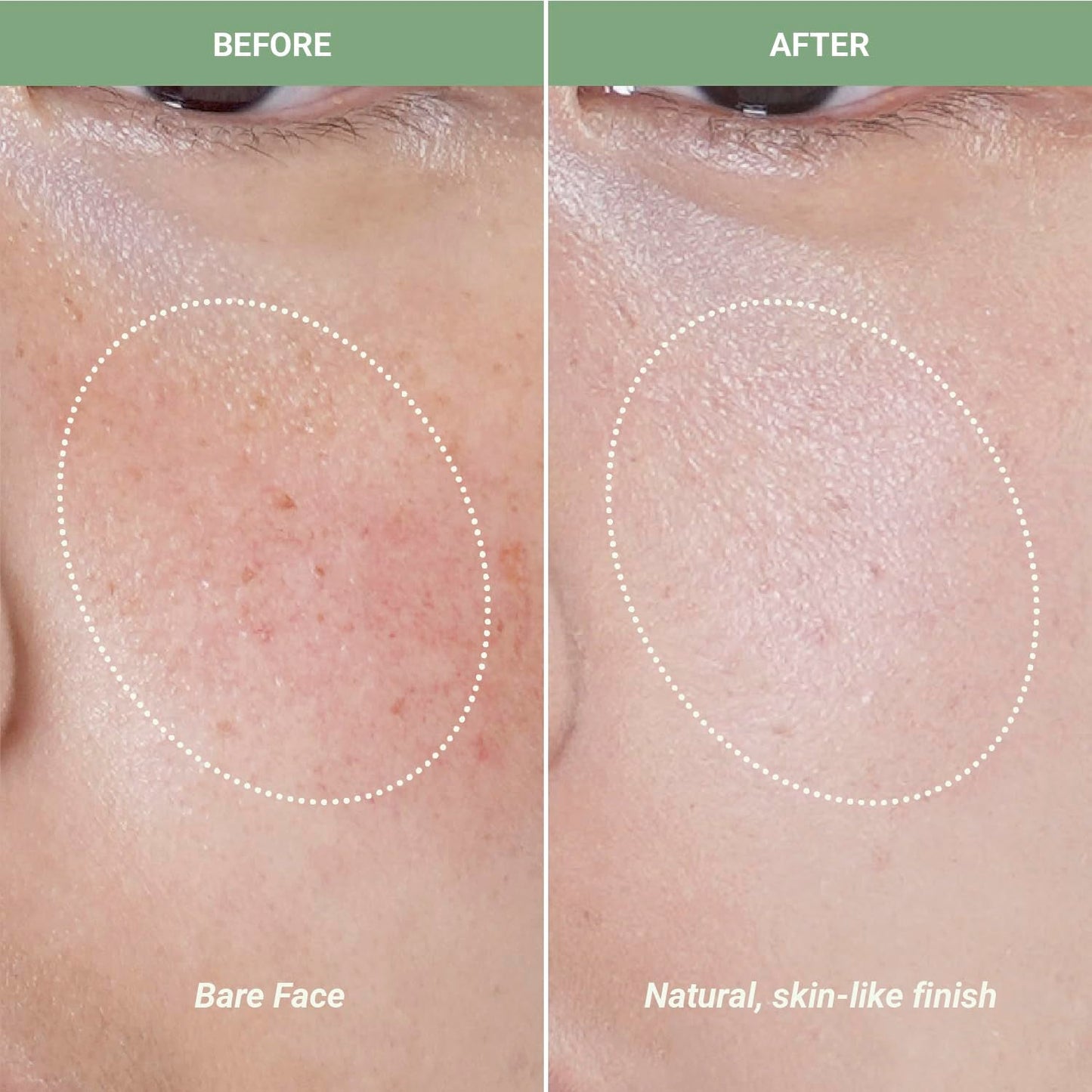 Calming Red Spot Cream - 30ml | Soothing Skin Corrector