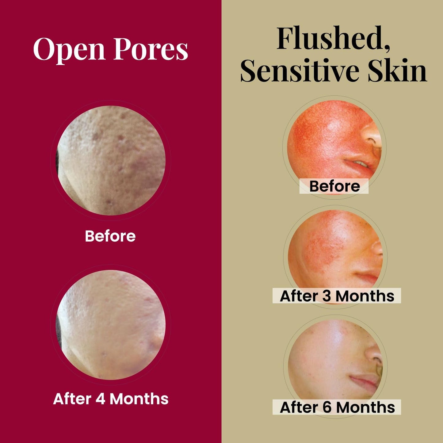 Natural Glow Facial Serum Set