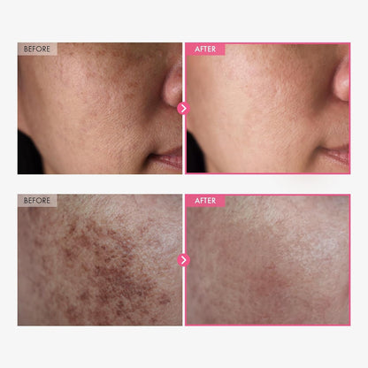 Brightening Face Cream for Even Skin Tone 50ml