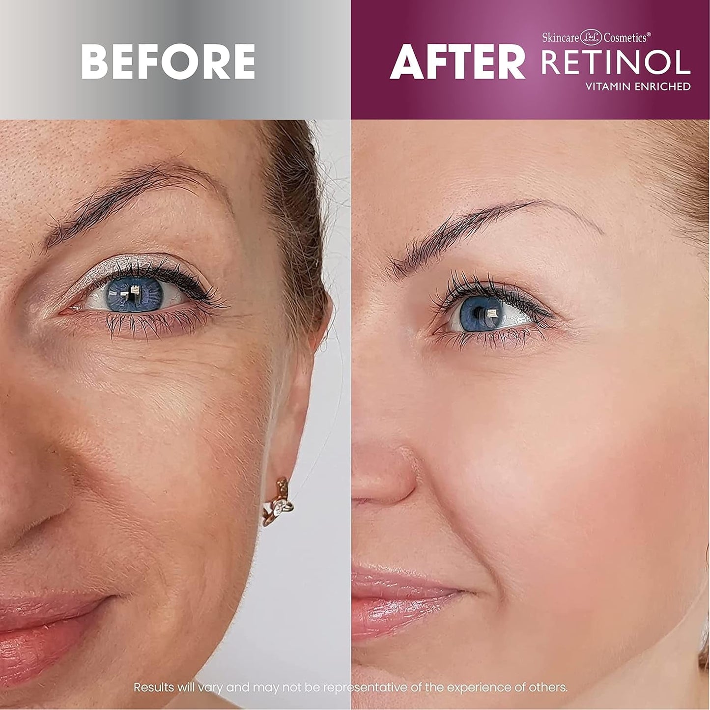 Anti Aging Retinol Face Cream - Firming Moisturizer