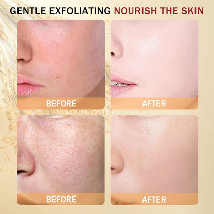 Gentle Dual Exfoliating Rice Serum Set 2 x 30ml