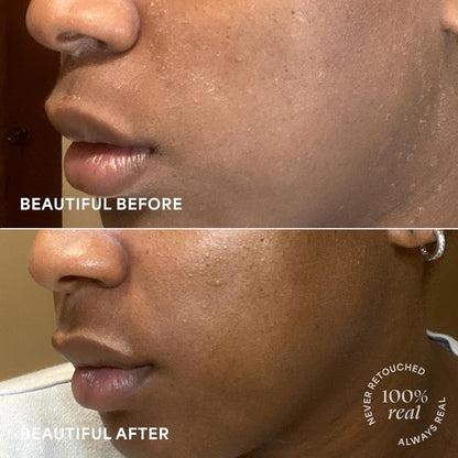 Intense Hydrating Day Night Face Cream for Dry Skin