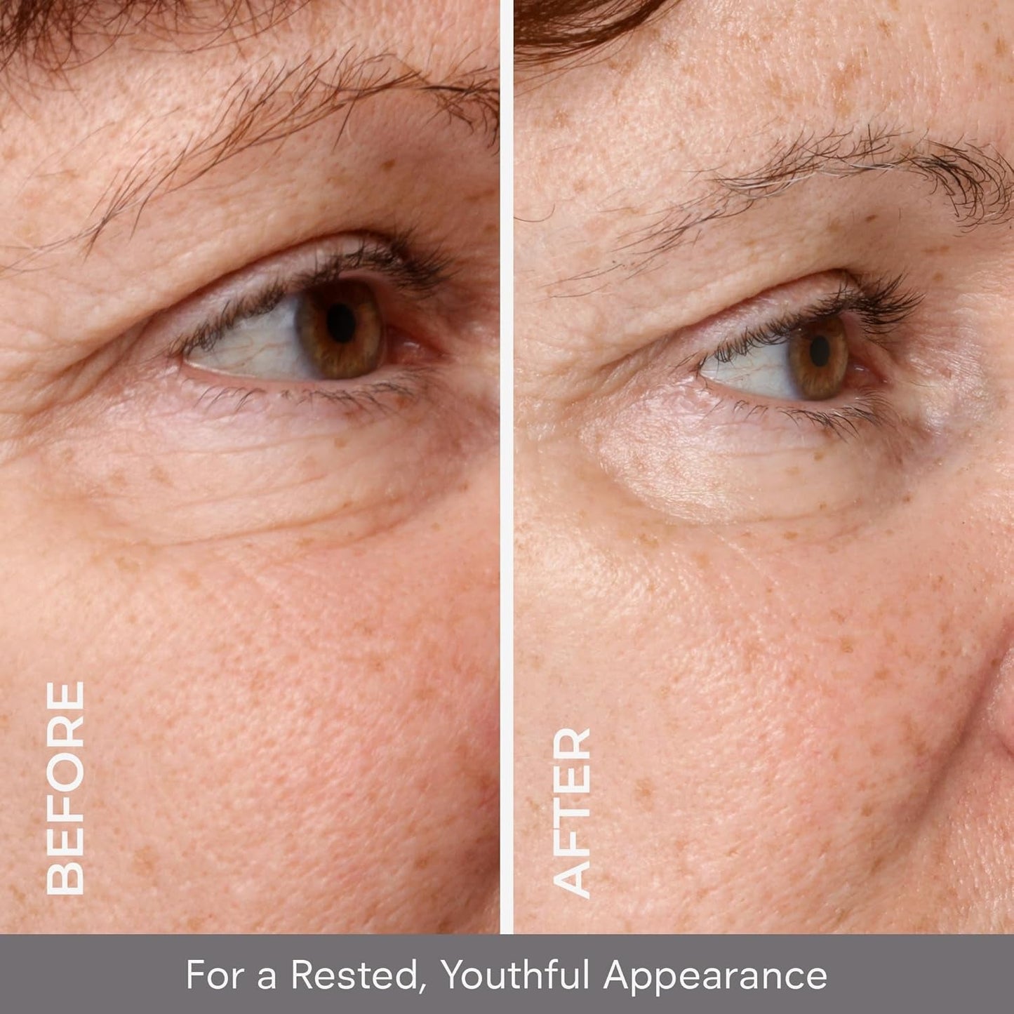 Anti Aging Eye Serum - Firms and Brightens Eyes