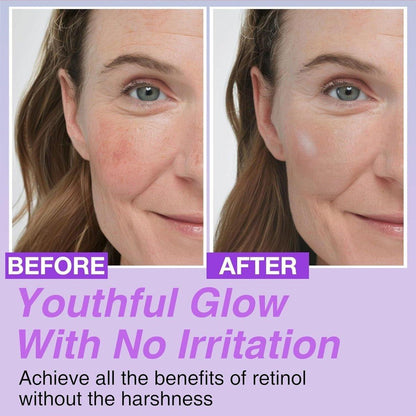 Natural Anti Aging Face Serum Concentrate