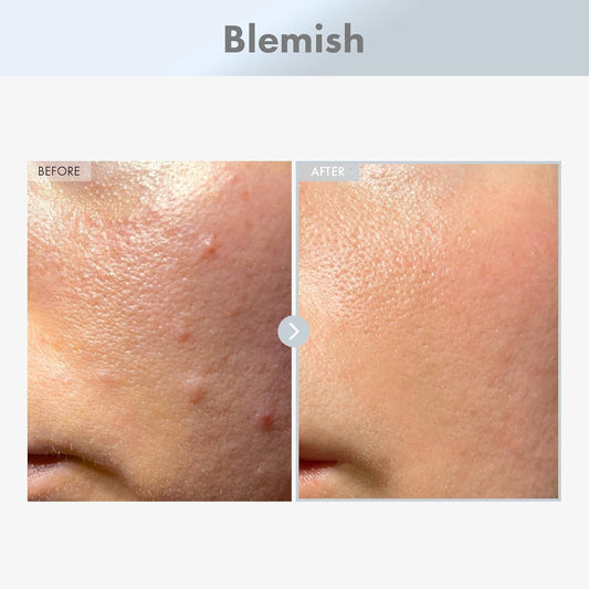 TOSOWOONG Pure Niacinamide Serum 30ml - Minimized Pores and Balanced Skin Tone