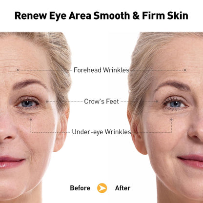 Anti Aging Eye Serum 20ml - Reduces Wrinkles & Dark Circles
