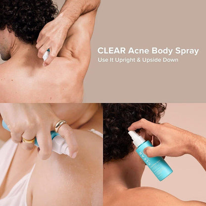 Salicylic Acid Acne Spray for Body & Back Breakouts