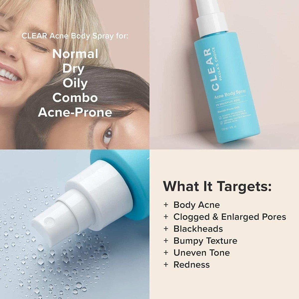 Salicylic Acid Acne Spray for Body & Back Breakouts