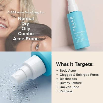 Salicylic Acid Acne Spray for Body & Back Breakouts