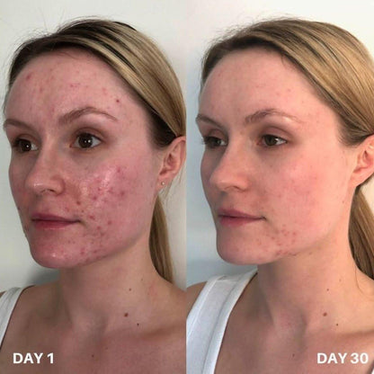 Gentle Skin Cleanser 100ml | Effective Face Purifier
