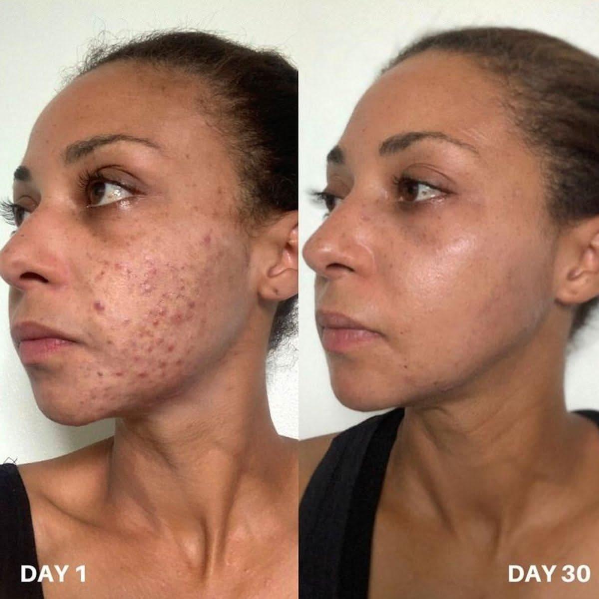 Gentle Skin Cleanser 100ml | Effective Face Purifier