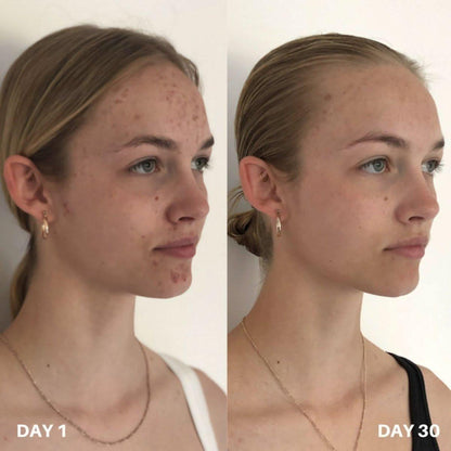 Gentle Skin Cleanser 100ml | Effective Face Purifier