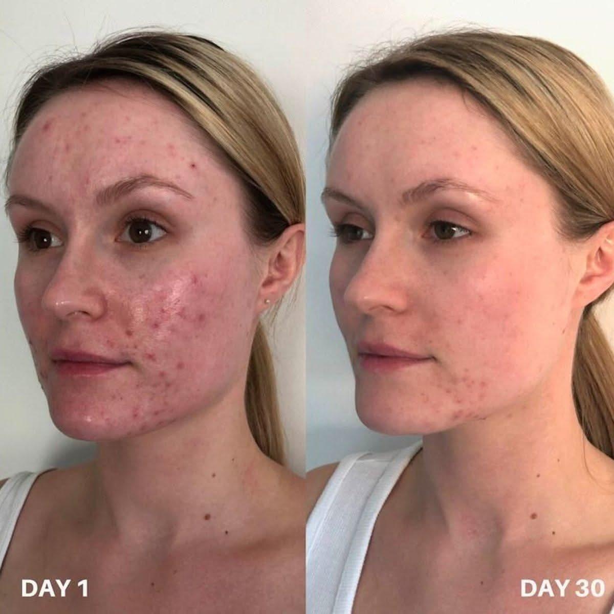 Gentle Skin Cleanser 250ml | Effective Daily Skin Care