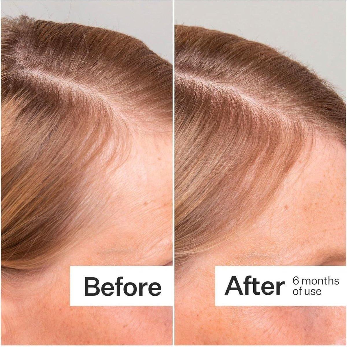 Nourishing Hair Serum for Scalp Revitalization