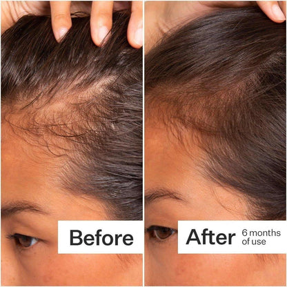 Nourishing Hair Serum for Scalp Revitalization