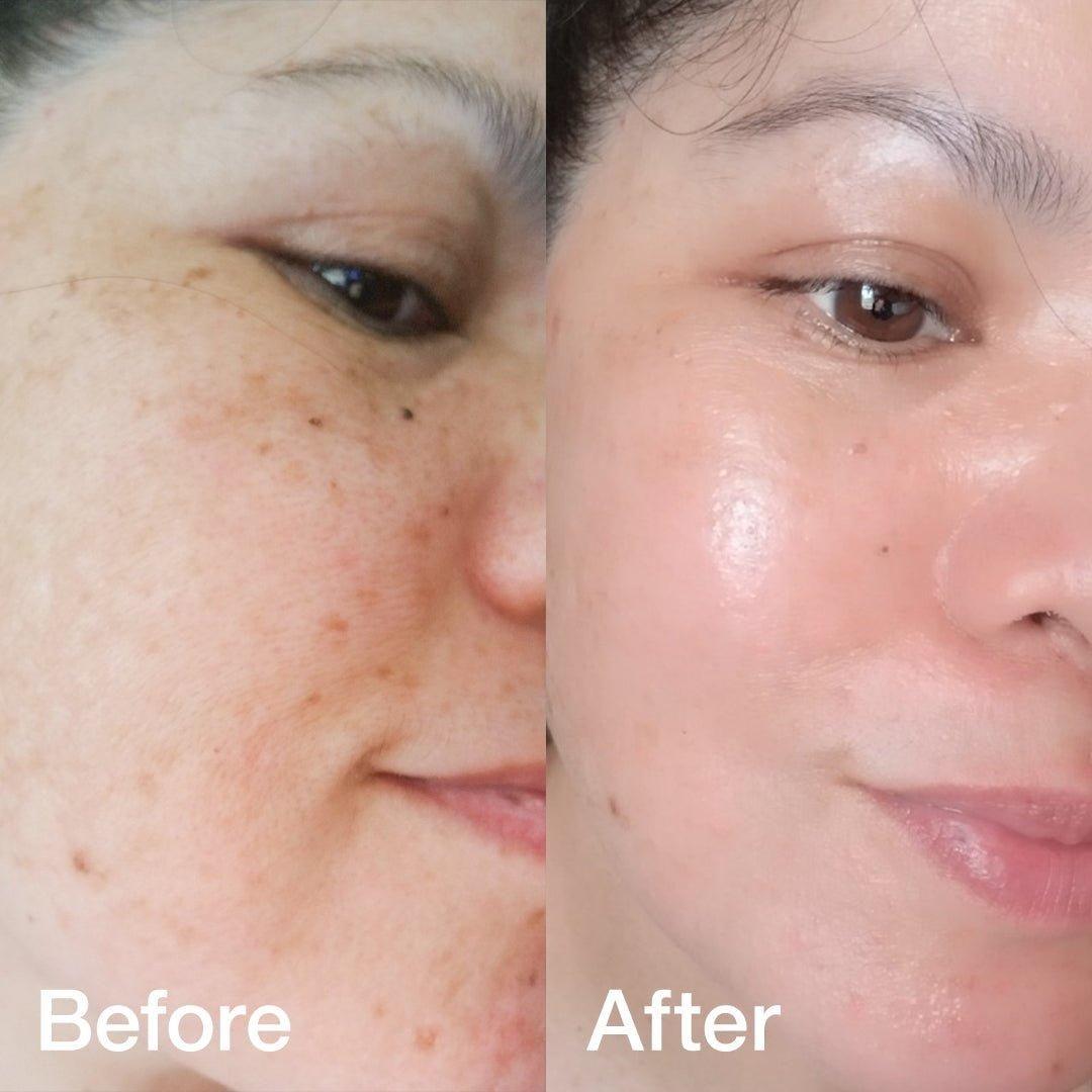 Intensive Collagen Care Kit | Hydrating Anti Aging Skincare