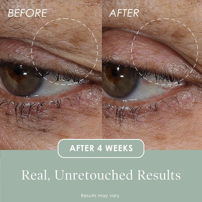 Anti Aging Eye Cream Lift and Firming Treatment