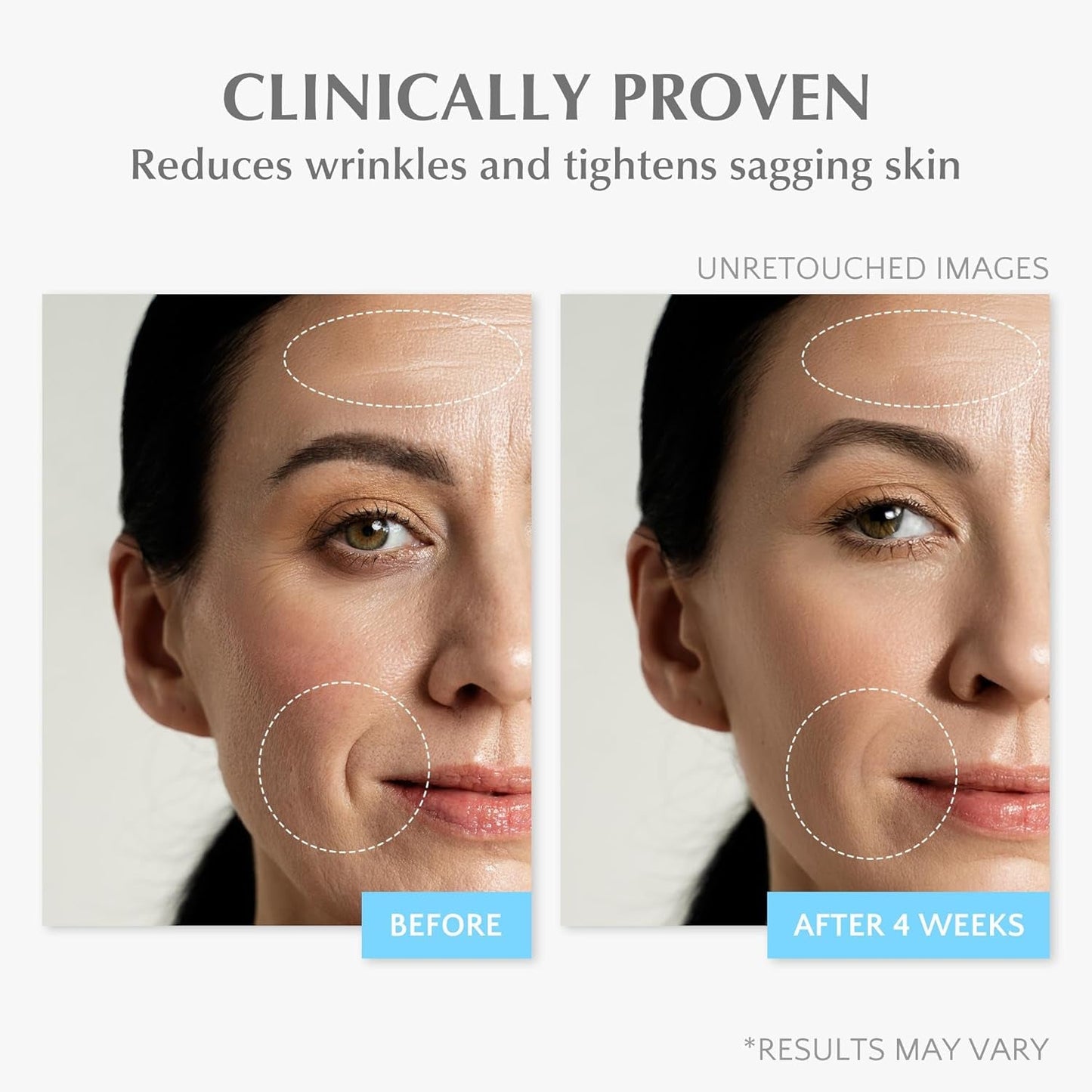Anti Aging Moisturizing Face Cream with Retinol