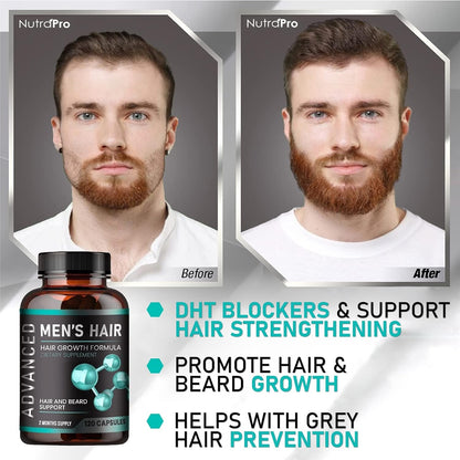 Strong Hair Growth Vitamins for Men - Biotin Capsules