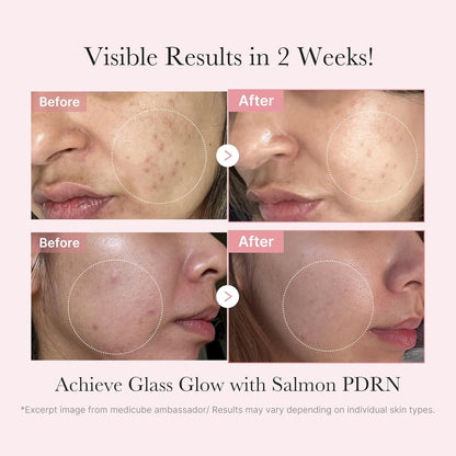 Natural Glow Skincare Kit 5 Piece Set