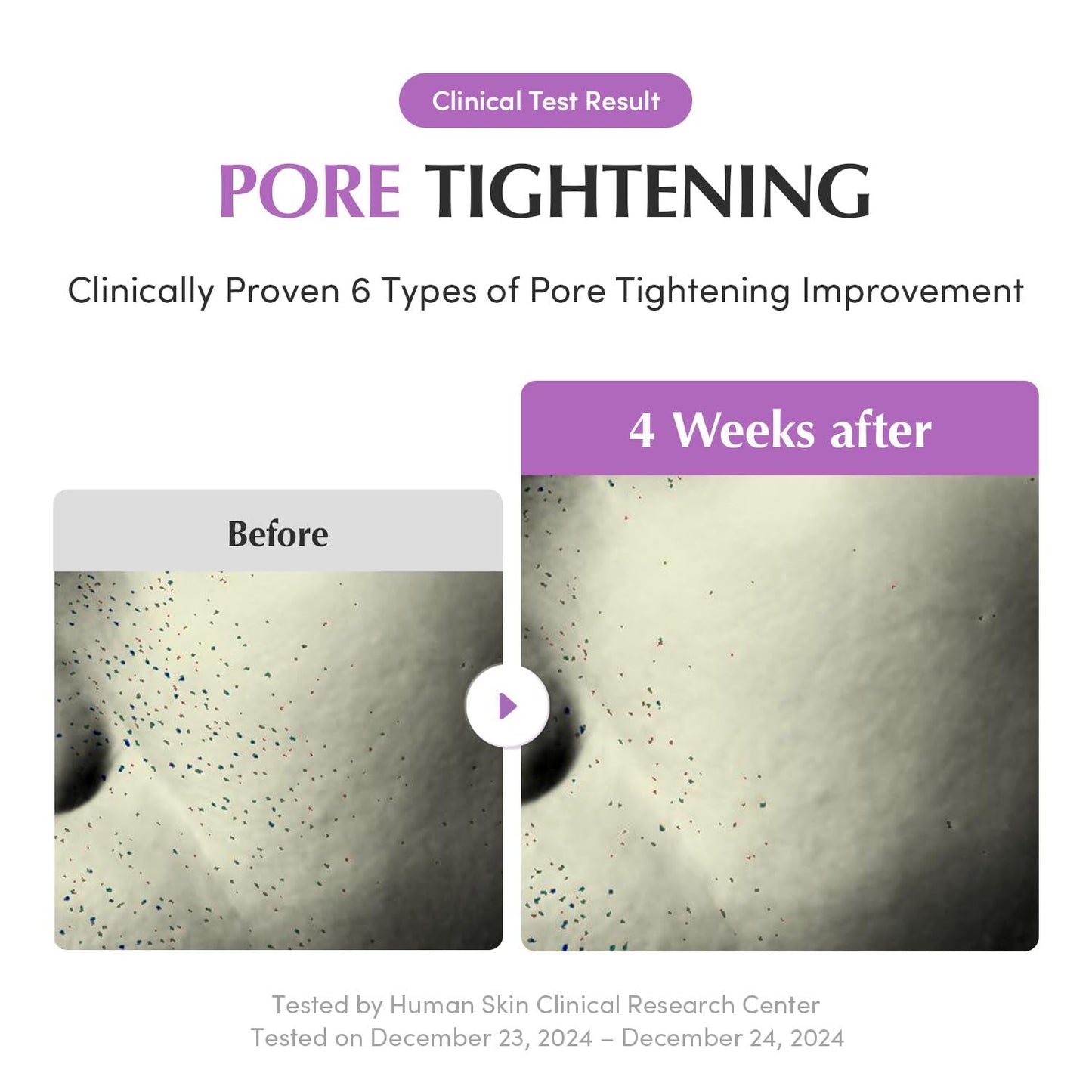 Advanced Pore Reducing Face Serum 30ml