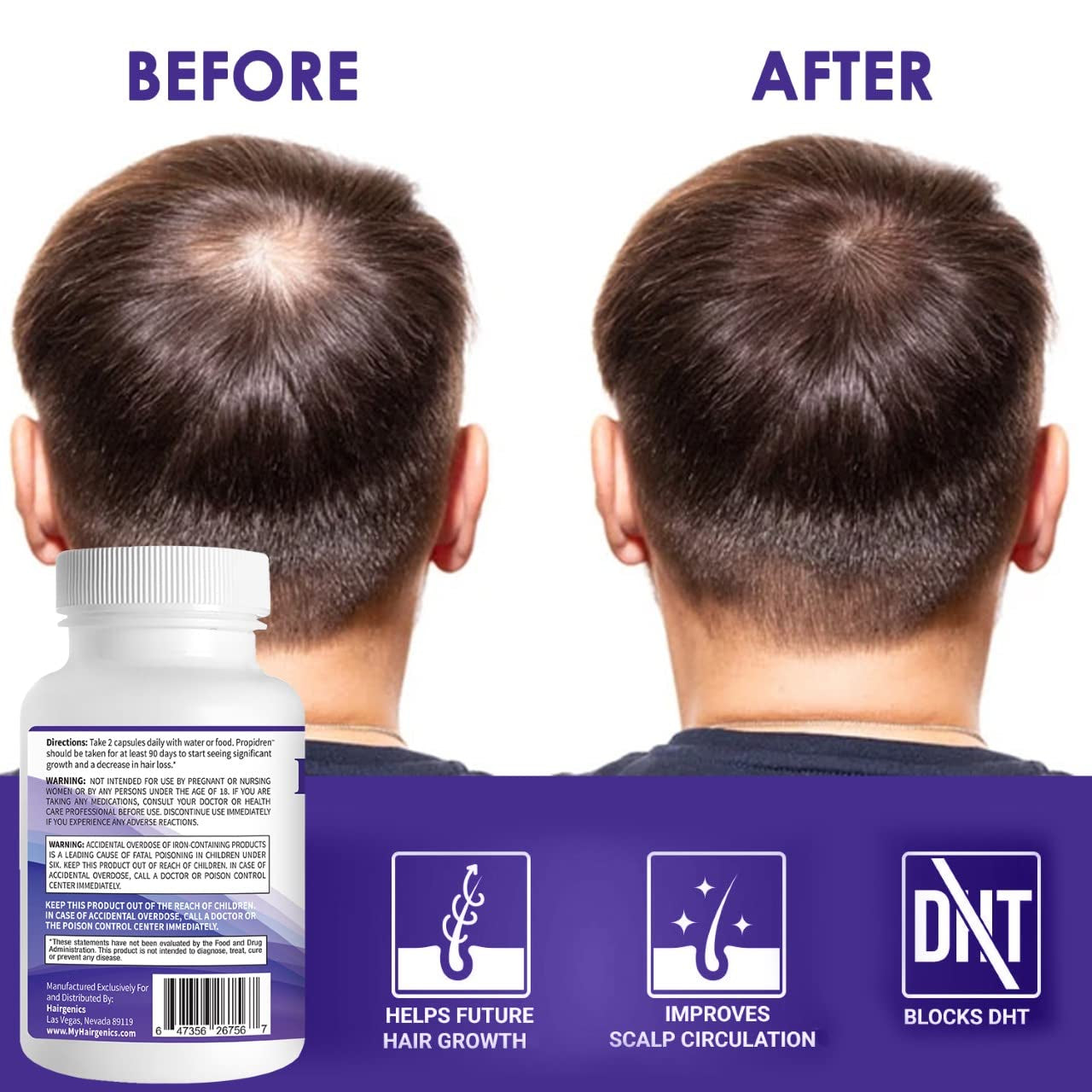 Natural Hair Growth Supplement with Biotin and Saw Palmetto