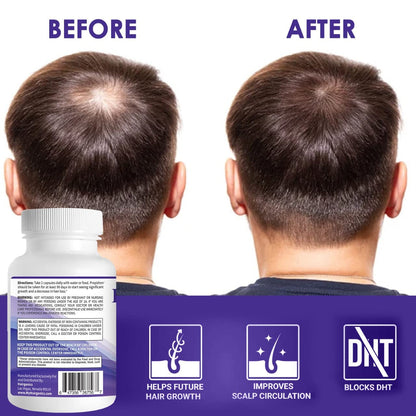 Natural Hair Growth Supplement with Biotin and Saw Palmetto