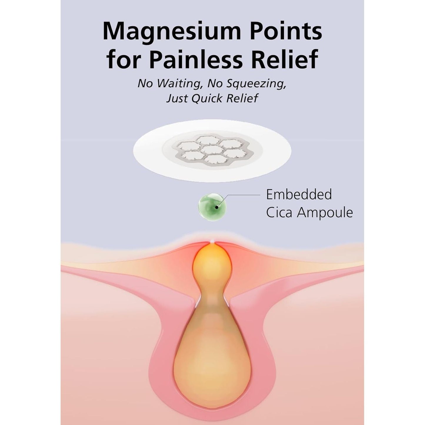 Soothing Magnesium Acne Patches - 30 Count Korean Spot Treatment