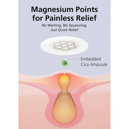 Soothing Magnesium Acne Patches - 30 Count Korean Spot Treatment