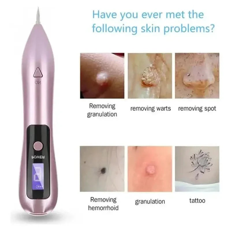 Easy Skin Tag & Tattoo Remover Pen