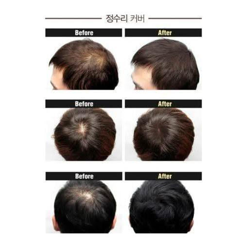 Natural Hair Growth Cushion for Thinning Hair 16g