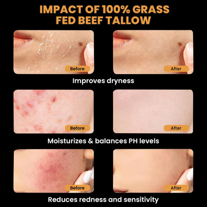 Gentle Soothing Skin Balm for Dry Sensitive Skin