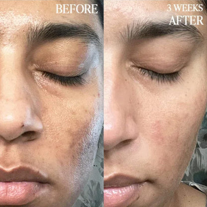 Purifying Kiwi Face Wash Gel Cleanser