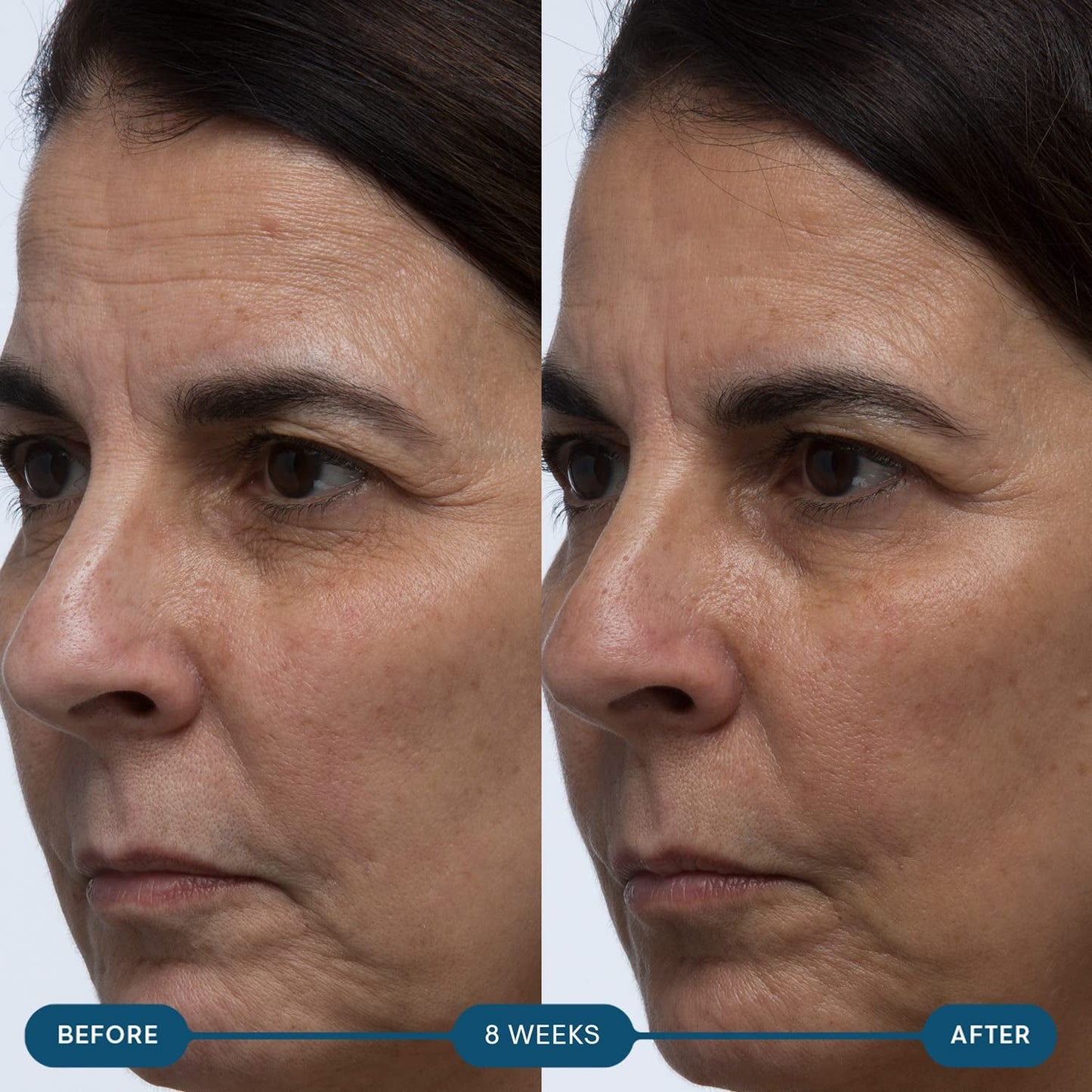 Natural Anti Aging Skin Vitamin Capsules