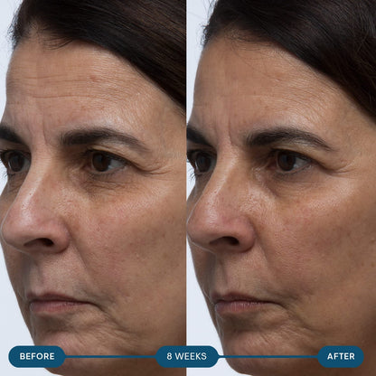 Natural Anti Aging Skin Vitamin Capsules