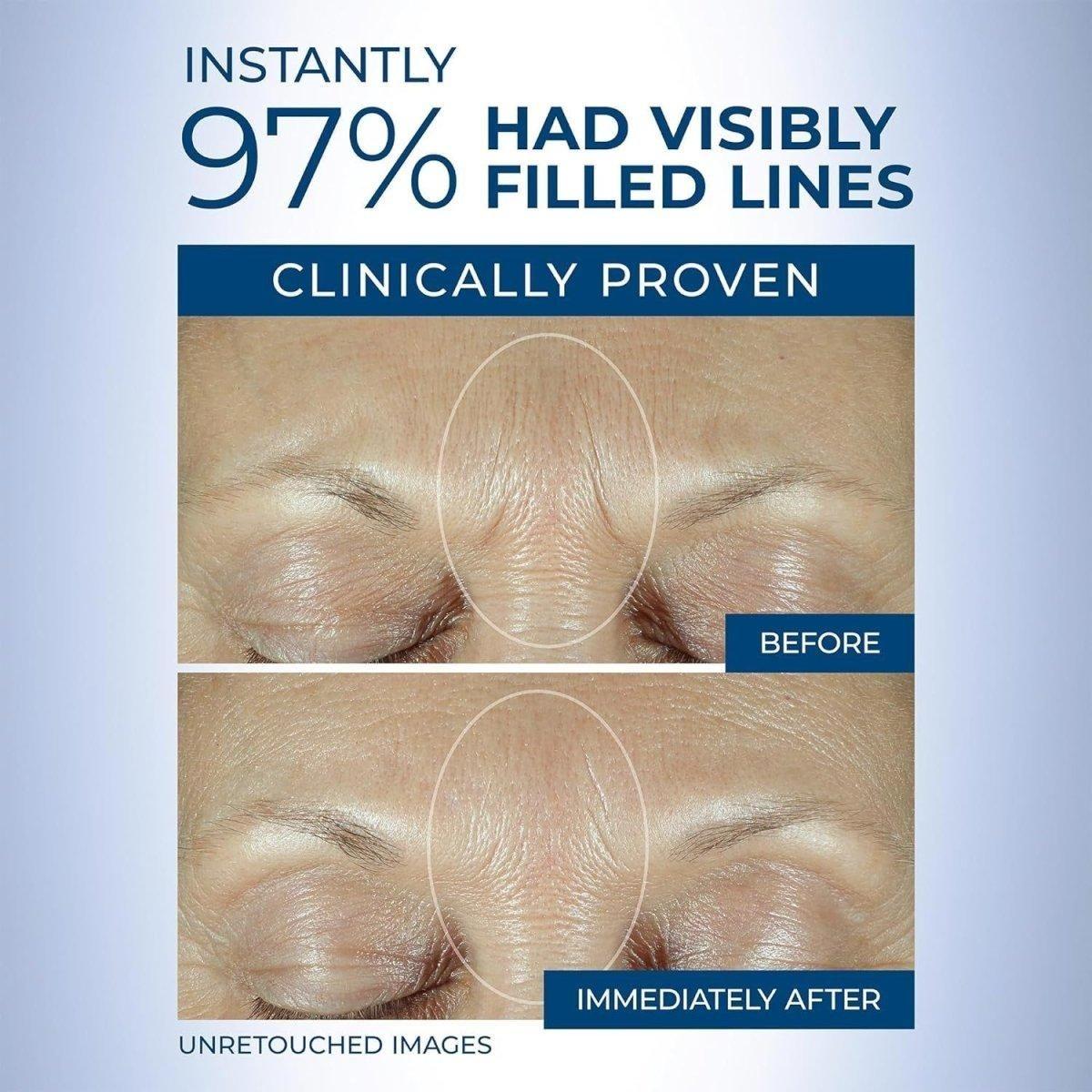 Anti-Aging Retinol Face Serum for Wrinkles & Fine Lines