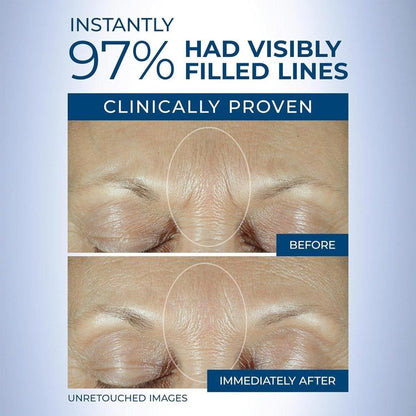 Anti-Aging Retinol Face Serum for Wrinkles & Fine Lines