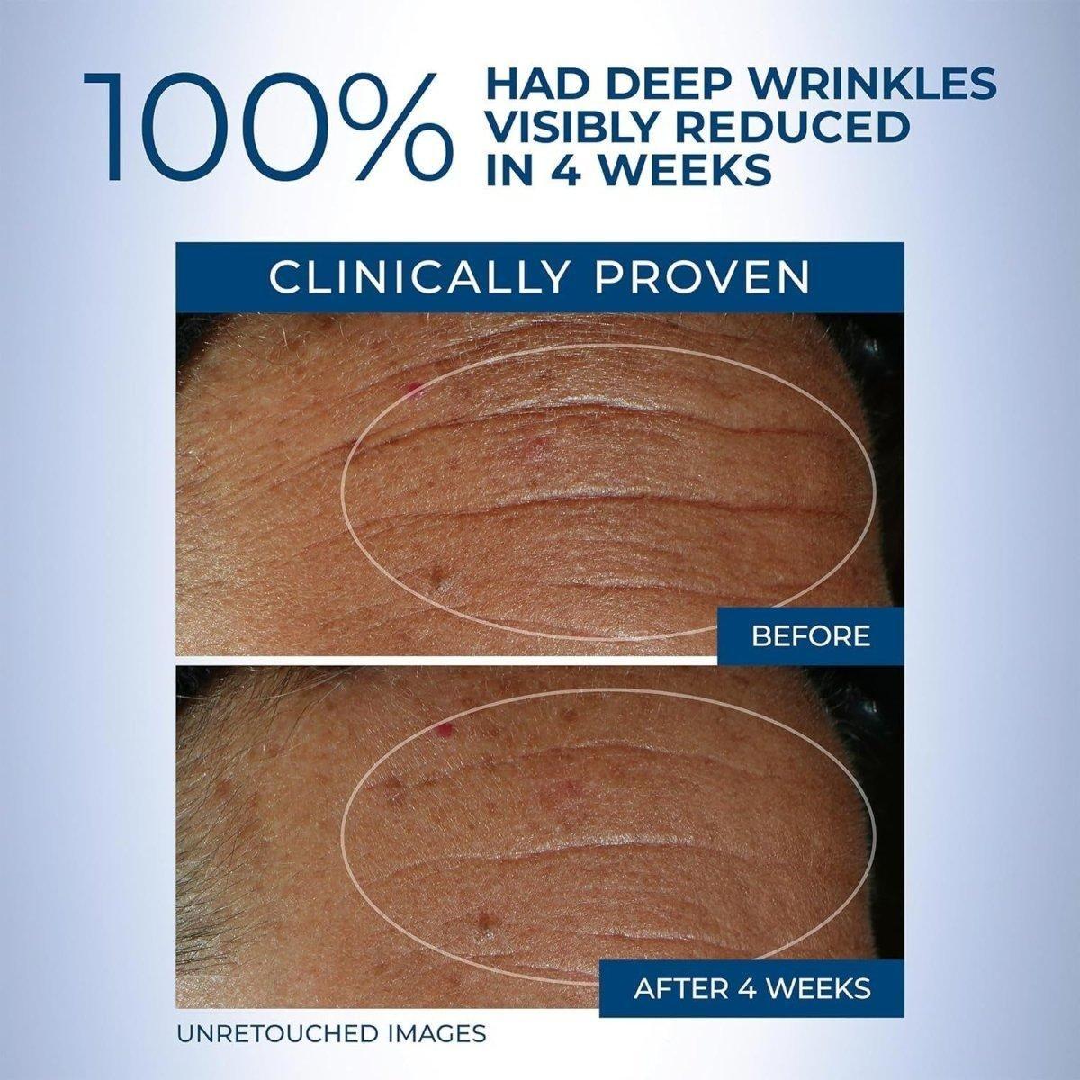 Anti-Aging Retinol Face Serum for Wrinkles & Fine Lines
