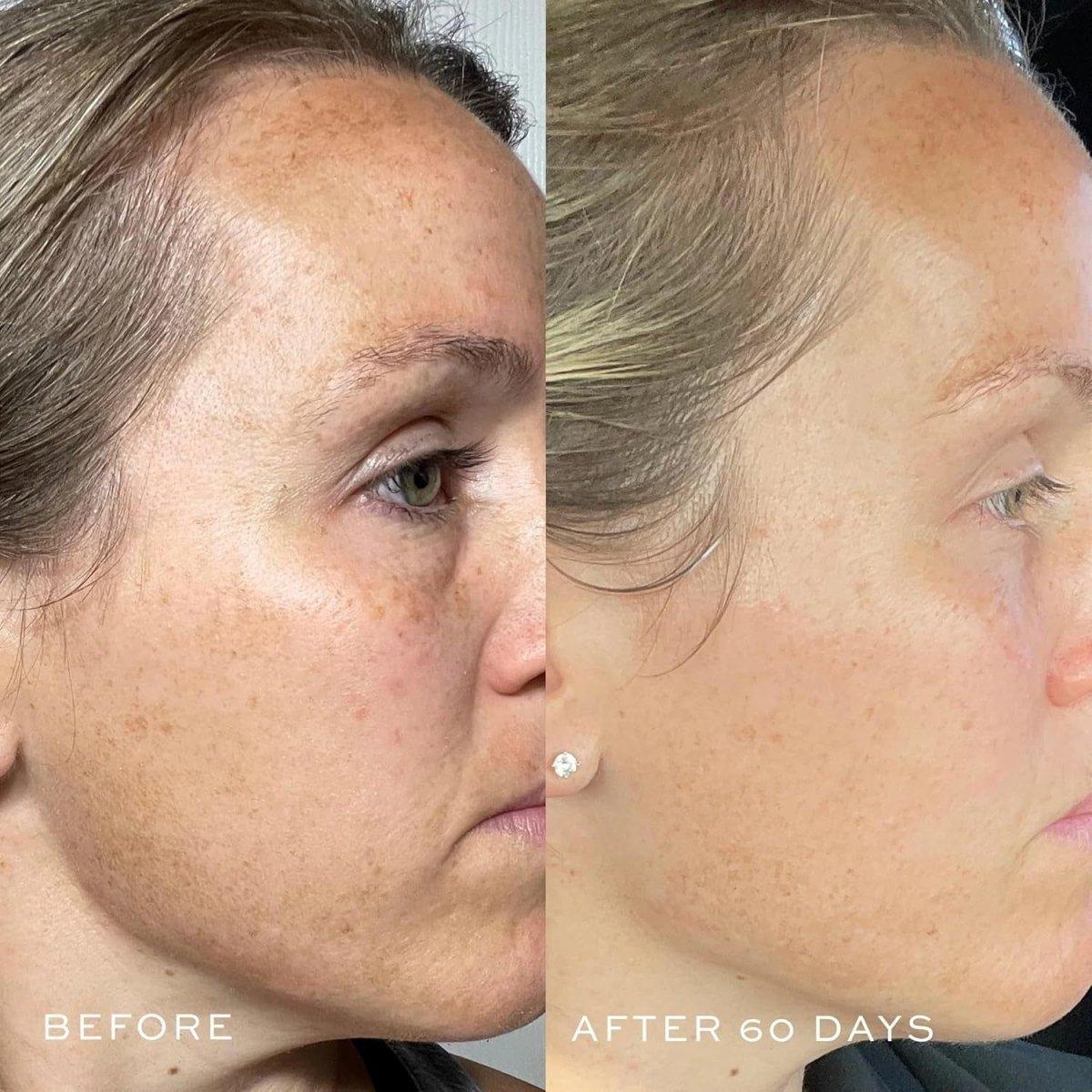 Powerful Anti Aging Face Serum 1oz