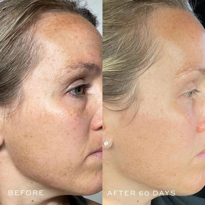 Powerful Anti Aging Face Serum 1oz
