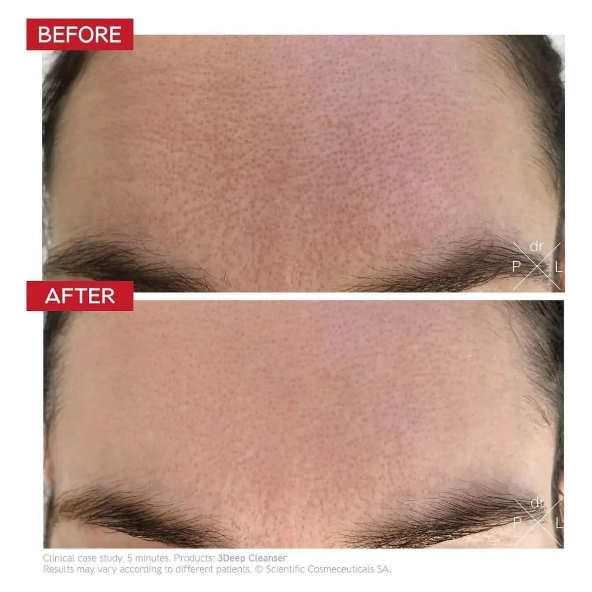 Gentle Exfoliating Facial Cleanser