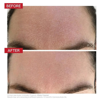 Gentle Exfoliating Facial Cleanser