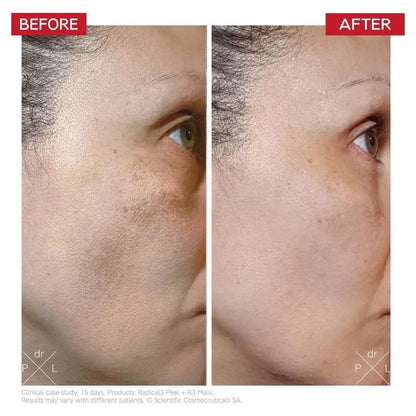 Gentle Exfoliating Facial Peel Serum 50ml