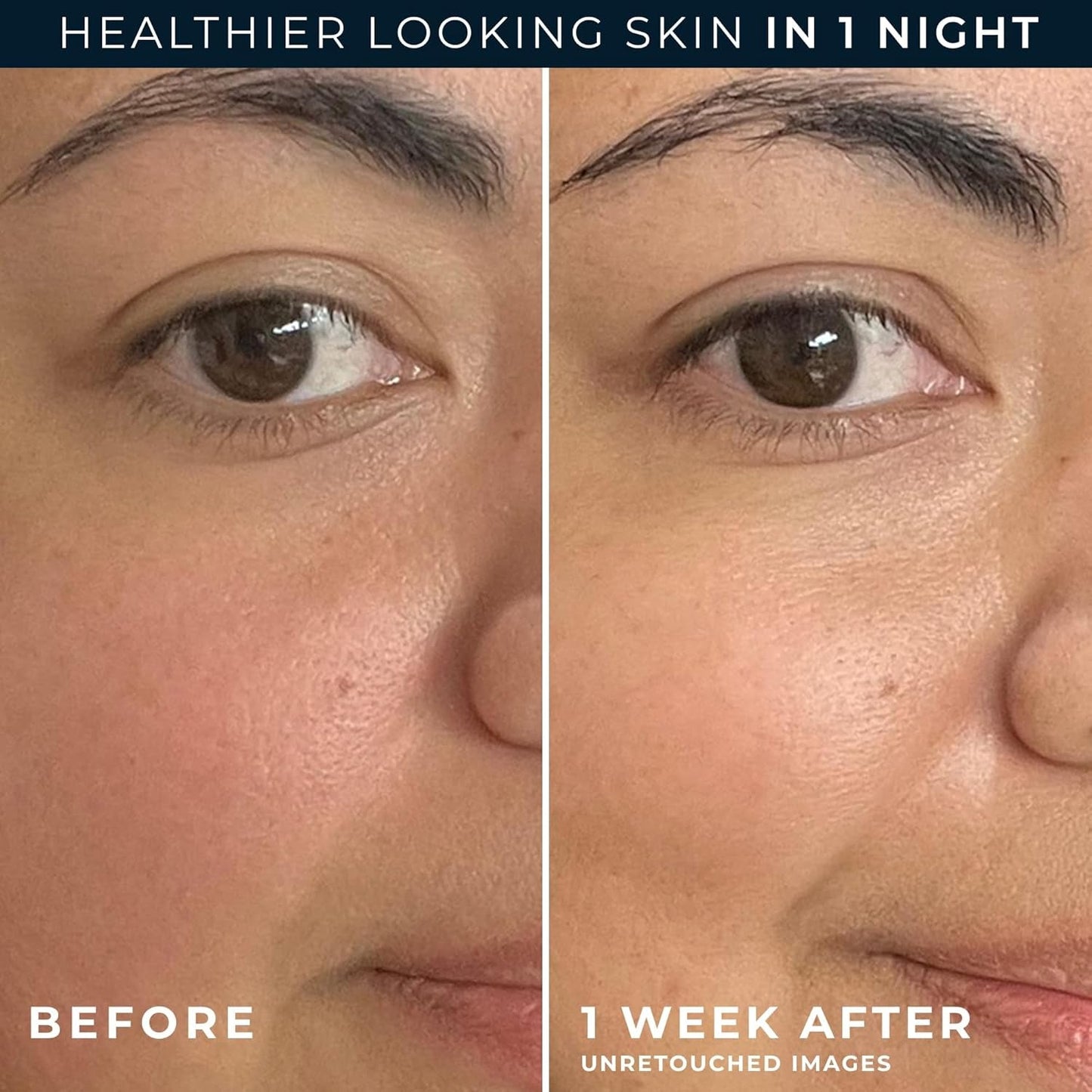 Intensive Night Moisturizer & Eye Cream Set