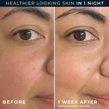 Intensive Night Moisturizer & Eye Cream Set