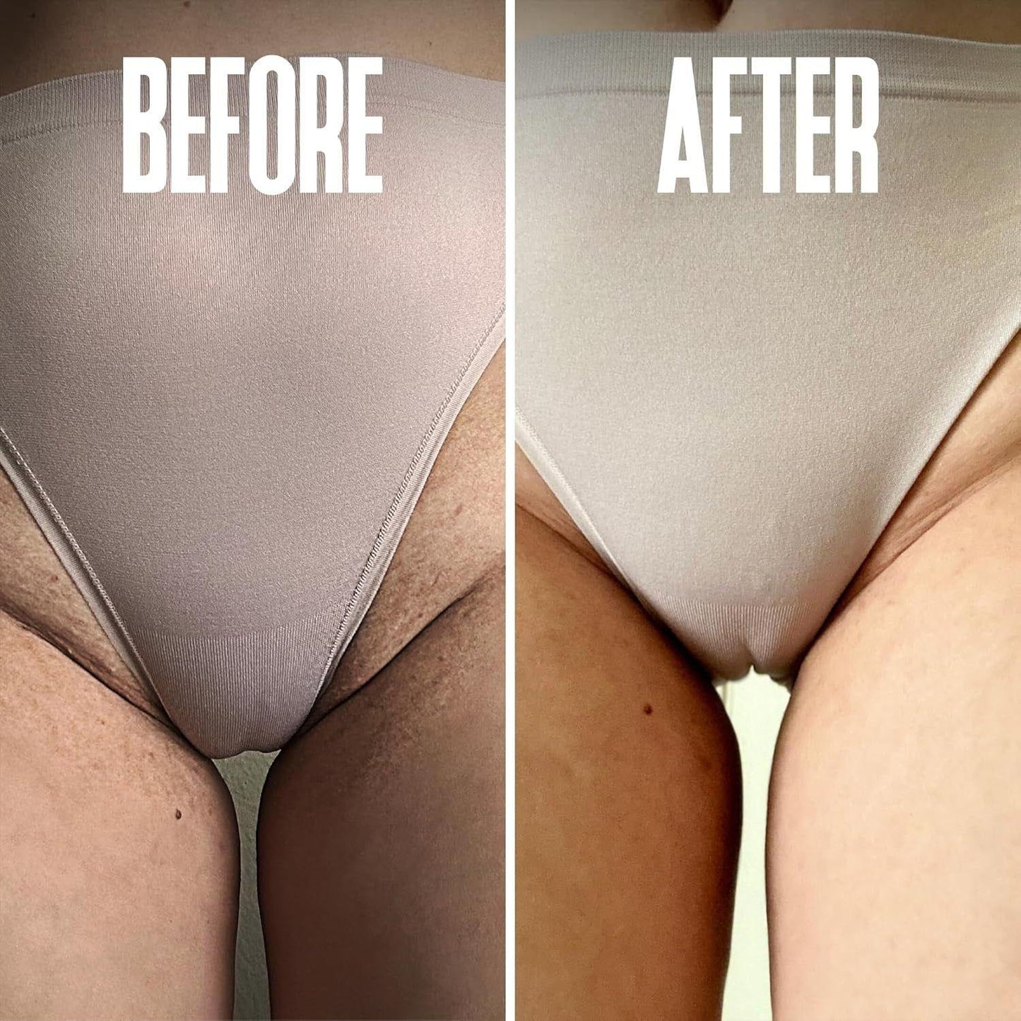 Soothing Ingrown Hair Removal Pads