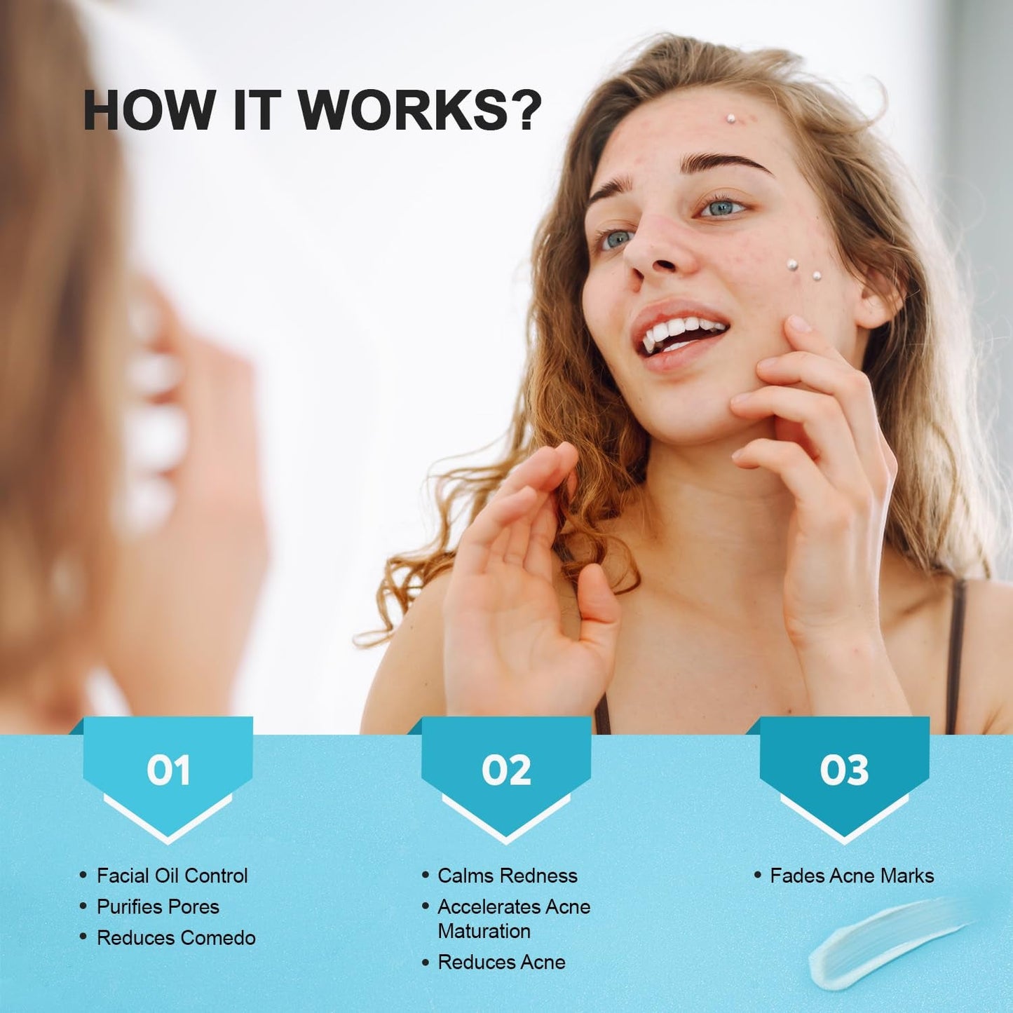 Natural Acne Treatment Gel Cream with 10% Azelaic Acid